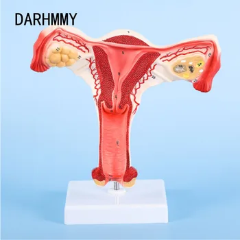 DARHMMY Ľudských Ženskej Maternice, vajcovodov, Vaječníkov Anatomický Model ľudskej anatómie model lekárske nástroje výučby