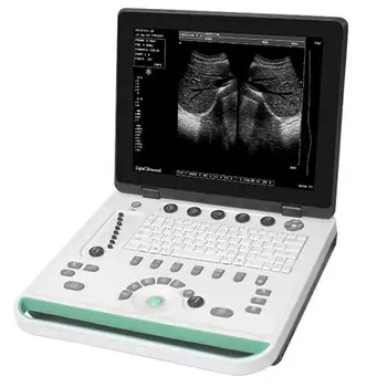 Zariadenia zdravotnícke prenosný ultrazvuk s tablet ultrazvuk prenosný skener s tlačiarňou